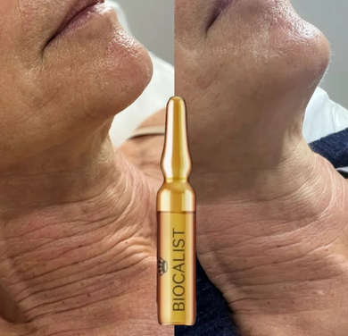 Formação Biocalist BIO-MICRONEEDLING com Kit - V.I.P.