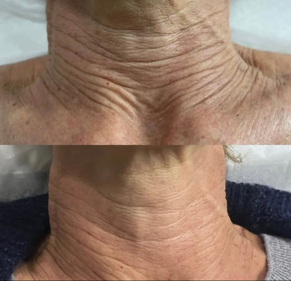 Rosto - Tratamentos Avançados Anti-Idade