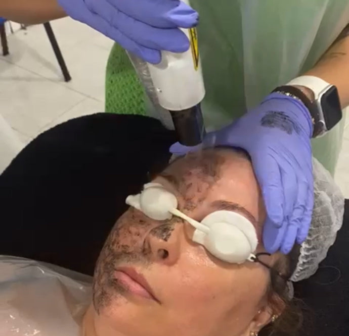 Rosto - Peeling Hollywood - A Pele das Estrelas