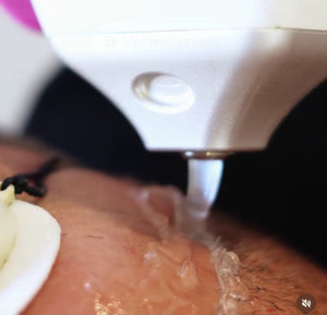 Rosto & Corpo - Laser 3 bandas - Depilação Prolongada