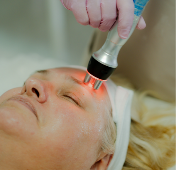 Rosto - Radio Frequencia - Firmeza e Rejuvenescimento