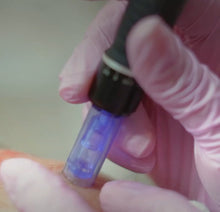 Carregar imagem no visualizador da galeria, Rosto - Microneedling - Indução de Colagénio