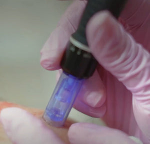Rosto - Microneedling - Indução de Colagénio