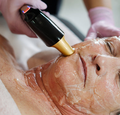 Rosto - HIFU Lifting Facial sem Cirurgia