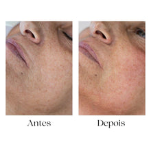 Carregar imagem no visualizador da galeria, Formação Skinarch os Exossomas na Estética - V.I.P.