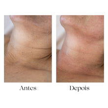 Carregar imagem no visualizador da galeria, Formação Skinarch os Exossomas na Estética - V.I.P.