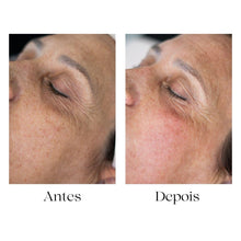 Carregar imagem no visualizador da galeria, Formação Skinarch os Exossomas na Estética - V.I.P.