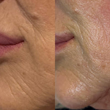 Carregar imagem no visualizador da galeria, Formação Skinarch os Exossomas na Estética - V.I.P.