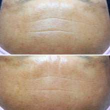 Carregar imagem no visualizador da galeria, Formação Skinarch os Exossomas na Estética - V.I.P.